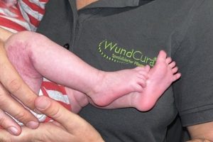 Versorgung_Baby